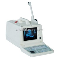 Ultrasound Scanner (soneo800B White &amp;amp; Black)