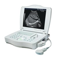 Digital Laptop Ultrasound Scanner(LEO-3000E1)