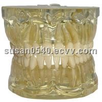 Transparent Tooth Extraction Model