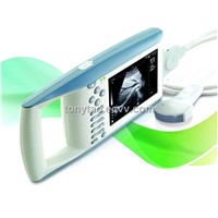 Digital Palm Ultrasound Scanner (KX5100)