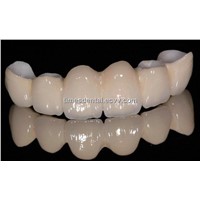 Dental Fixed Restoration Zirconia Crown and Bridge