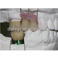 implant crown bisque try in