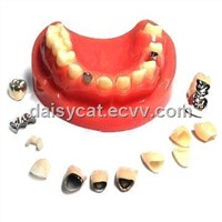 zirconia,PFM ,Inlay.FMC,Captet,Glod