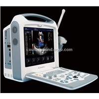 portable 3D digital color doppler ultrasound scannaer