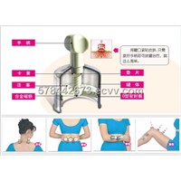 Chinese Medical Hand Pump Cupping Set YFC-4