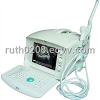 Ultrasound ,Ultrasound Scanner,B-Ultrasound Scanner,B-Ultrasound Diagnostic Equipment