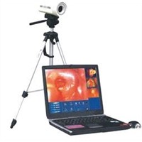 Digital Electronic Colposcope with image workstation
