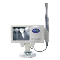 Dental Mulitifunction X-ray Reader &amp;amp; Intraoral Camera Intra oral cam Endoscope