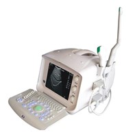 CE Approved Digital Portable Ultrasound Scanner (XK21355)