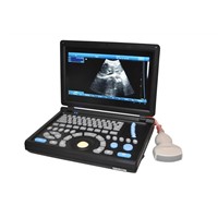 3D Full Digital Laptop Ultrasound Scanner (PC)