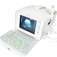 Digital Portable Ultrasound Scanner 6000A