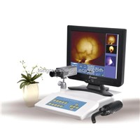 Portable Infrared Mammary Diagnostic (TR5000B)