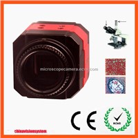 China Professional Cheap 5MP USB Microscope Camera