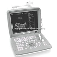 Full Digital Portable Ultrasound Scanner (KR-2088V)