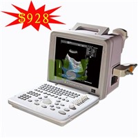 Portable ultrasound machine price &amp;amp; B-ultrasound scanner - MSLPU01
