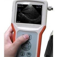 V1 Palm Ultrasound Scanner