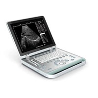 SS-7 Laptop Ultrasound Scanner(ultrasonic,black white,Imaging System)