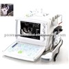 Veterinary Ultrasound Scanner-VET WHYC-30P/ Echocardiography machine / ultrasonic transducer mhz