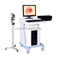 TF-6000 19&amp;quot; LCD Screen Trolley electronic digital colposcope