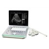 15 inch Mobile Laptop Ultrasound Diagnostic Scanner