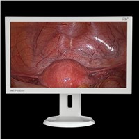 21.5&amp;quot; medical endoscopic and surgical display monitor