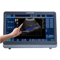 Ultrasound Color Doppler Touch Screen ultrasound scanner vascular ultrasound equipment