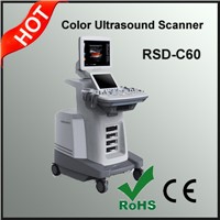 Trolley Color Doppler Ultrasonic Diagnostic System