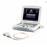 HP-UC500 Full-Digital Laptop Ultrasound Scanner