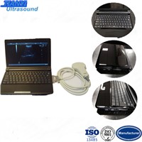 LCD Screen PC Based Small Laptop Ultrasound Equipment