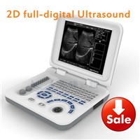Sonography echo/ultrasound machine/usg scanner/CE echo device/ultrasoinc notebook machine
