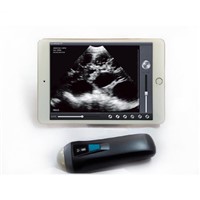Sonostar Ipad ultrasound scanner wireless convex ultrasound Sector probe for pregnancy UProbe-1