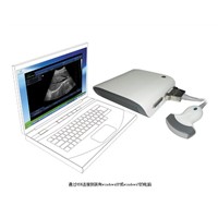 Sonostar Portable Ultrasound Equipment ultrasound 4D ultrasound box with High Quality UBox-10