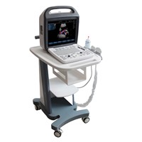 Sonostar Trolley professional color doppler ultrasound machine China ultrasound scanner SS-1000