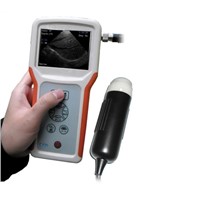 Sonostar advanced mini portable ultrasound machine handheld ultrasound scanner V1