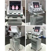 HIFU high intensity focused ultrasound machine for face lift skin tightening