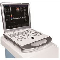 Portable ultrasonic diagnostic devices type color doppler ultrasound equipment