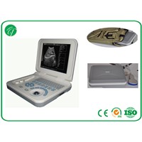 PL-3018 Full Digital Laptop Ultrasound Scanner