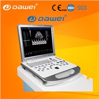 Laptop Color Doppler Ultrasound Price &amp;amp; Portable Color Doppler Ultrasound Machine