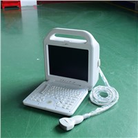 Human Use Laptop Ultrasound Scanner ATNL/51353A LCD