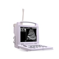 Portable Ultrasound Machine &amp;amp; Ultrasound Scanner &amp;amp; Device