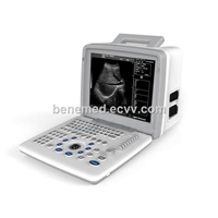 Portable Black &amp;amp; White Ultrasound Scanner BW-5 with 12 Inch LED Screen &amp;amp; Two Probe Connector