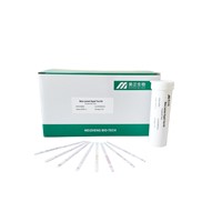 Easy Use Quinolones Rapid Test Kit for Milk Antibiotic Residue