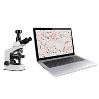 QB-200A Laptop Sperm Quality Analyzer, Semen Test
