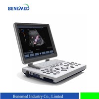 Notebook Color Doppler Ultrasound Scanner BENE-3S with 15 Inch LCD Screen & 3 Probe Connector