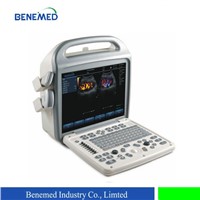 Portable Color Doppler Ultrasound Scanner BENE-3 with 15 Inch LCD Screen