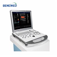 15&amp;quot;LED Medicinal Monitor Color Doppler Portable Type Ultrasound Scanner