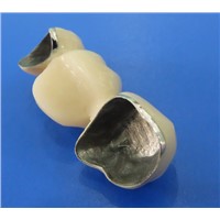 CAD-CAM Rubber 3D Printed Crowns Are Easy to Maintain & Fit