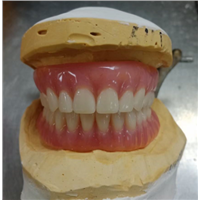REMOVABLES | DENTURES Dental Pfm Crown from China Dental Lab
