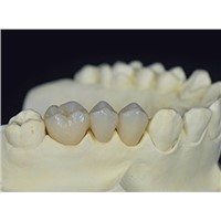 Ultra-Translucent Zirconia China Dental Zirconia Crowns