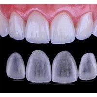 Veneers Dental Lab Crowns &amp;amp; Bridges
